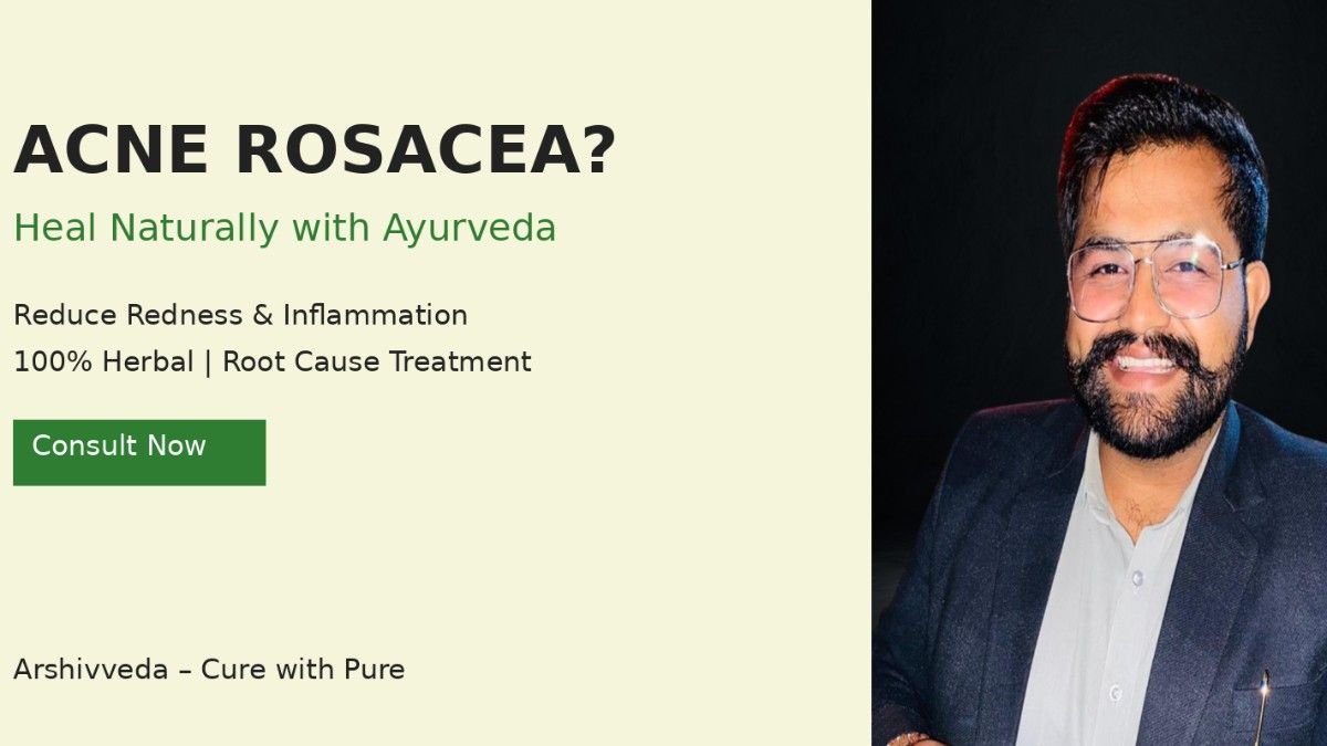 Acne Rosacea – Causes, Symptoms, Ayurvedic Treatment & Natural Remedies