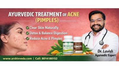 Ayurvedic Treatment of Acne (Pimples): Natural Skin Healing Approach